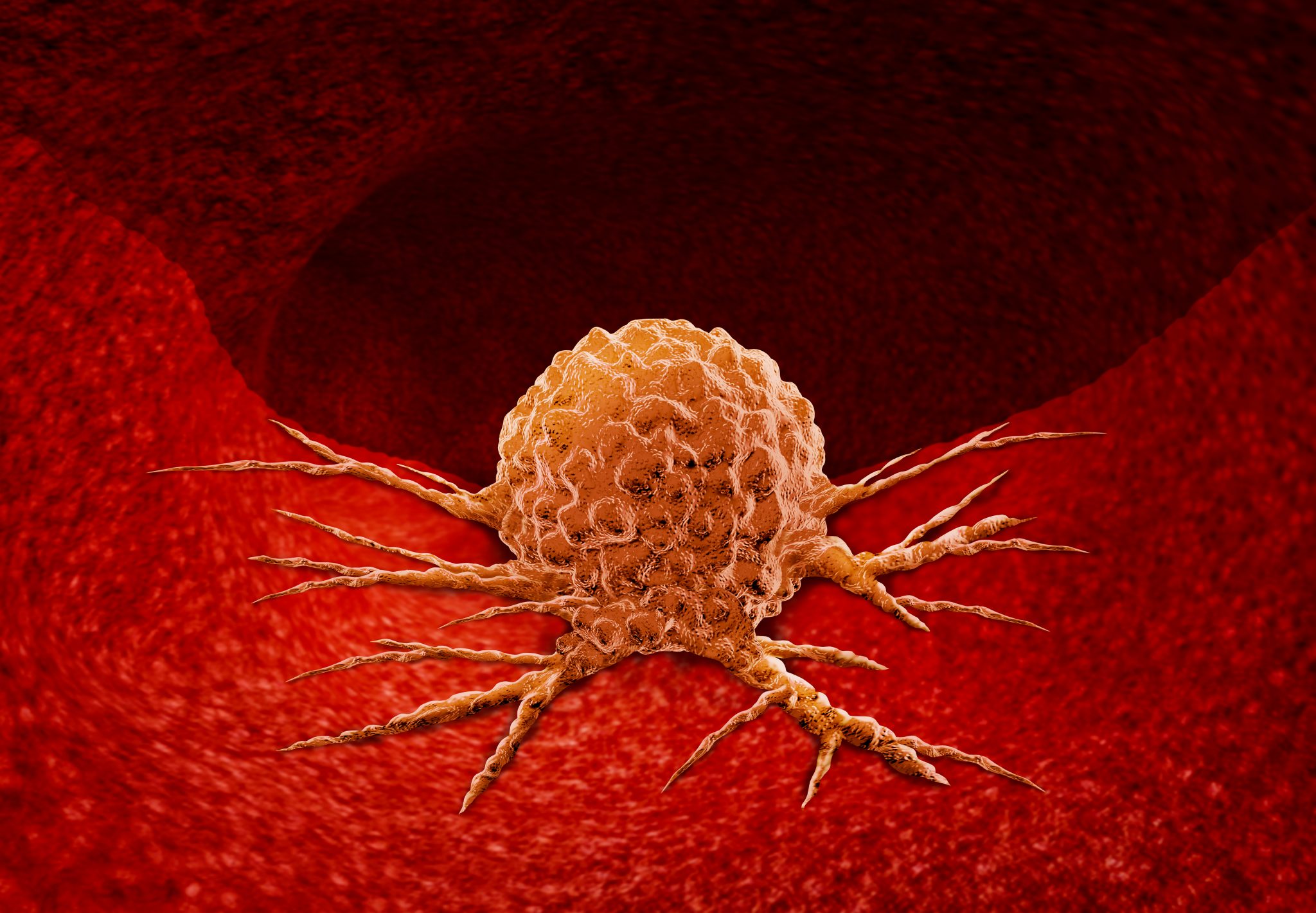 Dostarlimab For Treatment Of DMMR Advanced Solid Tumors